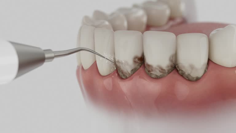 Reliable Tooth Extraction contractor in Mesilla, NM by Smile Center Dentistry